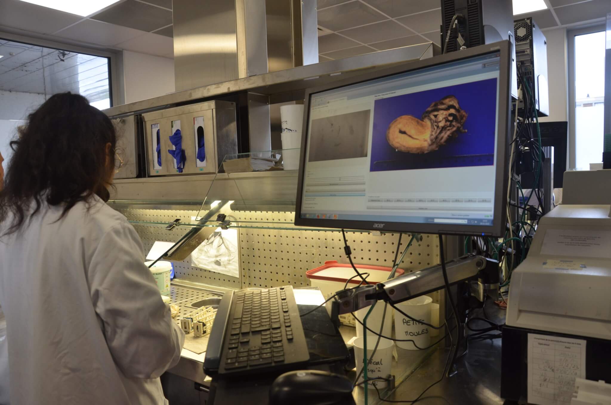 Technicienne dans un laboratoire d'anatomopathologie avec un écran affichant une vue d'une coupe d'utérus